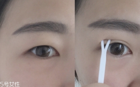雙眼皮貼一般多少錢？