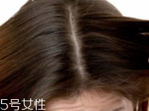 油性頭發(fā)跟什么有關？離不了這6個原因