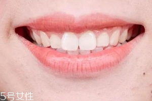 口紅病有哪些癥狀？使用不當(dāng)引發(fā)癌癥