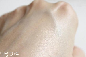白癜風(fēng)與身體免疫功能有關(guān)系嗎？兩者關(guān)系密切