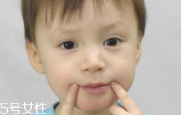 冬天爛嘴角什么原因？有可能營養(yǎng)不良