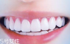 牙線和漱口水是否必要？抑菌護(hù)牙好習(xí)慣