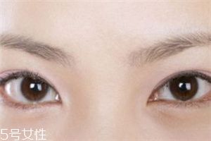 割雙眼皮后怎樣恢復快？女人不能割雙眼皮的時期