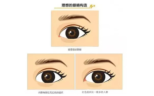 開外眼角和開內眼角哪個好？開眼角有可能會回縮