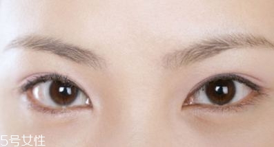 割雙眼皮的術(shù)前準(zhǔn)備有哪些？割雙眼皮的常見(jiàn)做法