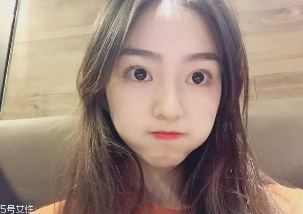 割雙眼皮要注意什么？割雙眼皮充血是正?，F(xiàn)象