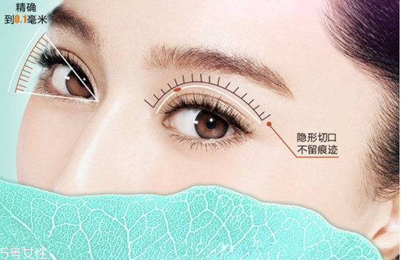 韓式雙眼皮是永久的嗎？圓眼睛不適合做雙眼皮