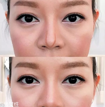 眉粉可以當(dāng)鼻影用嗎？眉粉這樣畫鼻影