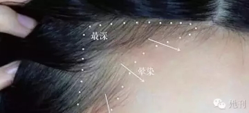 眉粉可以當(dāng)發(fā)際線粉嗎？解救高發(fā)際線的技巧