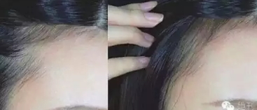 眉粉可以當(dāng)發(fā)際線粉嗎？解救高發(fā)際線的技巧