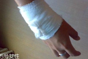 被蜈蚣咬傷后能治愈嗎？科學(xué)家有新發(fā)現(xiàn)