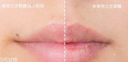 蘭芝唇膜吃進(jìn)去怎么辦？擁有水嫩嘴唇