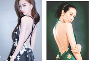 怎樣矯正背溝缺失？減肥運(yùn)動(dòng)是關(guān)鍵