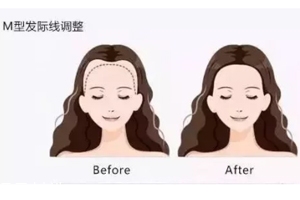 發(fā)際線粉填充和發(fā)際線筆哪個好？配合使用才最完美