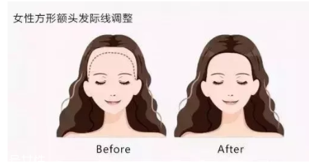 發(fā)際線粉填充和發(fā)際線筆哪個(gè)好？配合使用才最完美