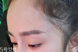 發(fā)際線高怎么治？拯救發(fā)際線攻略