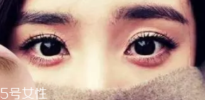 臥蠶和眼袋的區(qū)別是什么？臥蠶是肌肉眼袋是肥肉