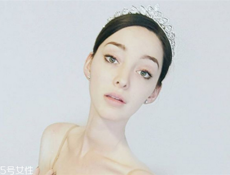 法令紋填充需要幾只玻尿酸？千萬不可過量