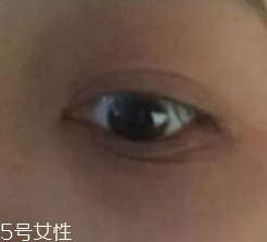黑眼圈用什么眼霜好？多效護(hù)理型眼霜是首選