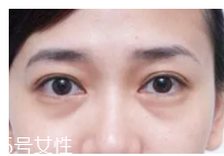 黑眼圈用什么眼霜好？多效護(hù)理型眼霜是首選