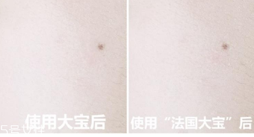 范爺同款法國(guó)大寶Embryolisse和大寶SOD蜜哪個(gè)好用？