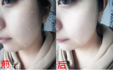 rosette去角質(zhì)凝膠怎么樣？真正的去角質(zhì)產(chǎn)品