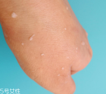rosette去角質(zhì)凝膠怎么樣？真正的去角質(zhì)產(chǎn)品