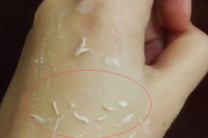 去角質(zhì)凝露多久用一次？皮厚一周一次