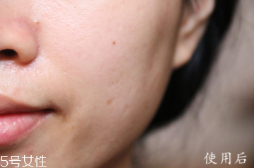 悅木之源和伊麗莎白雅頓哪個好？兩款精華大比拼