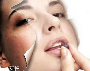 春季如何預(yù)防皮膚過敏？選擇敏感肌專用護(hù)膚品