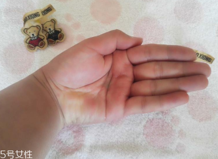 柳屋生發(fā)水有用嗎？一個月后長出新發(fā)