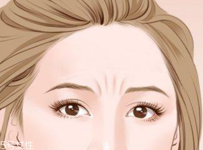 川字紋可以手術(shù)去除嗎？選擇手術(shù)需謹(jǐn)慎