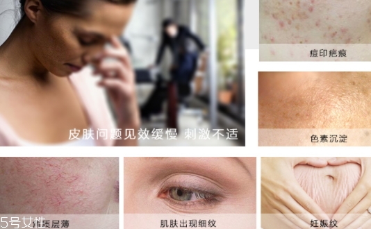 德國krauterhof蝸牛精華膏效果怎么樣？