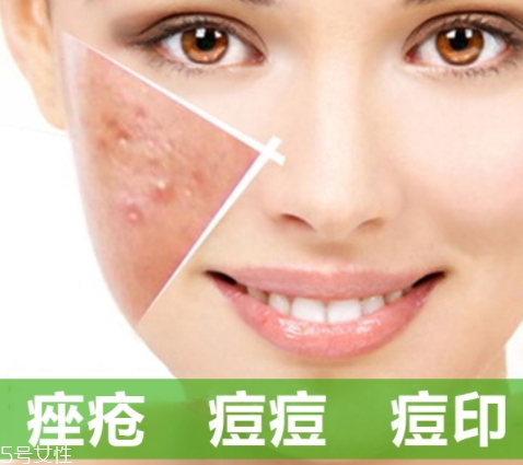 a酸怎么用？a酸怎么建立耐受？