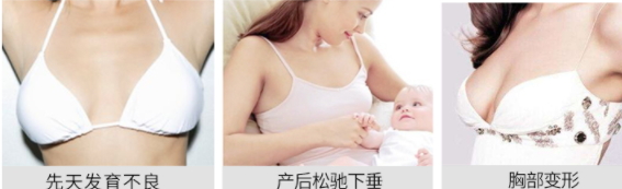 豐胸霜怎么用？豐胸霜使用手法詳解