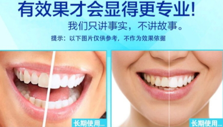 美白牙貼會(huì)反彈嗎？牙貼美白效果持續(xù)多久