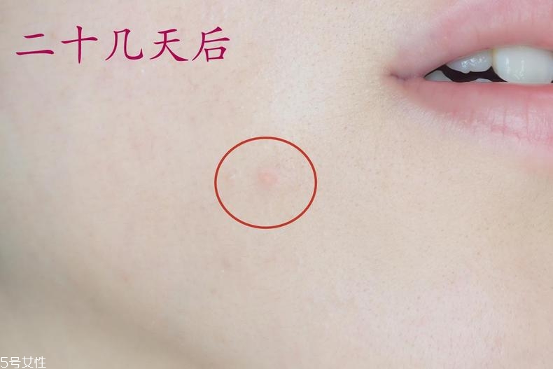 雅詩(shī)蘭黛晶透沁白防曬搖搖乳成膜快嗎？適合油痘皮嗎？