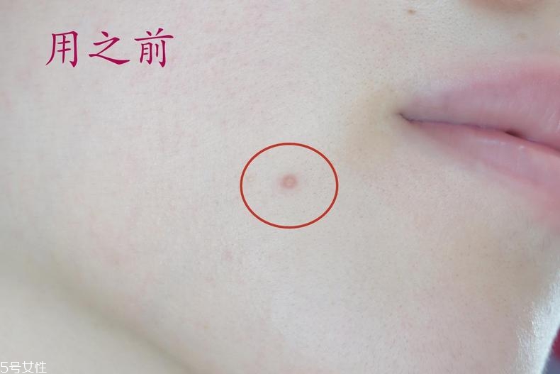 雅詩(shī)蘭黛晶透沁白防曬搖搖乳成膜快嗎？適合油痘皮嗎？