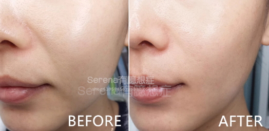 dermawand逆齡射頻注氧棒怎么用？