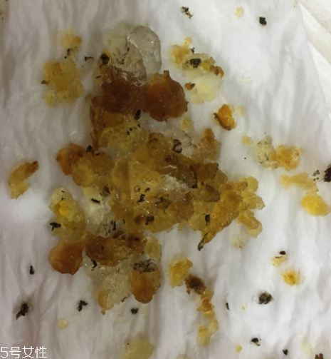 桃膠能和雞蛋一起吃嗎？桃膠配雞蛋可以嗎？