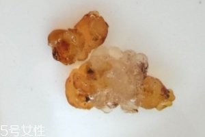 桃膠可以用開水泡嗎？用開水泡桃膠好嗎？