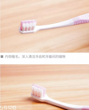 超聲波潔牙牙齒會變白嗎？超聲波潔牙心得
