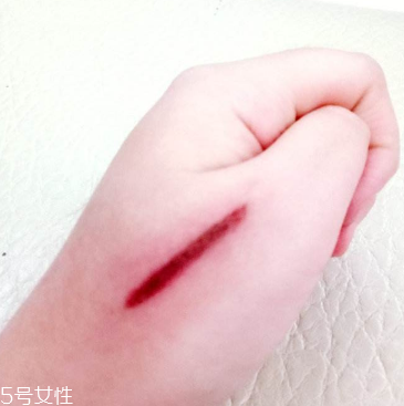 創(chuàng)可貼和肉連著怎么辦？創(chuàng)可貼連著肉怎么處理？