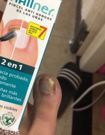 灰甲清有副作用嗎？灰甲清有哪些副作用？