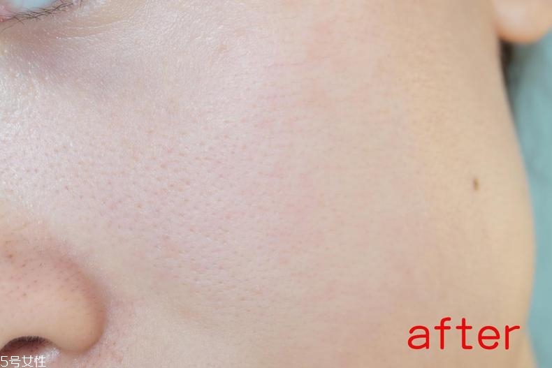 radha beauty vc精華白天能用嗎？敏感肌能用嗎？