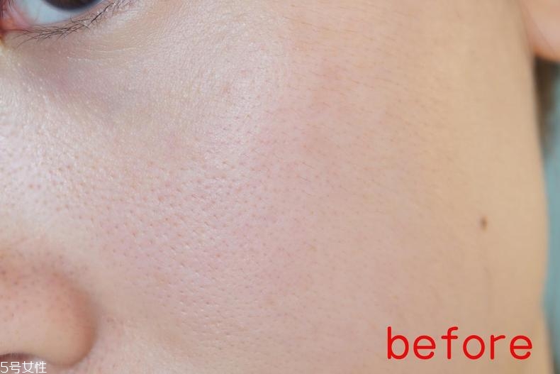 radha beauty vc精華白天能用嗎？敏感肌能用嗎？