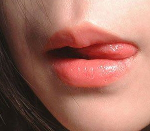兔唇修復(fù)要多少錢？兔唇修復(fù)風(fēng)險(xiǎn)大嗎