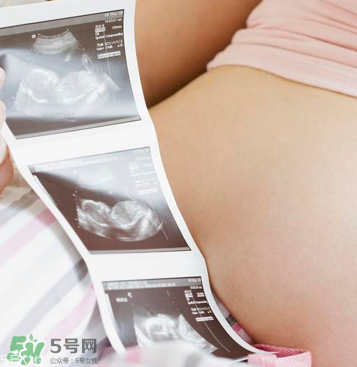 頭胎雙胞胎還能生二胎嗎？雙胞胎家庭能要二胎嗎？