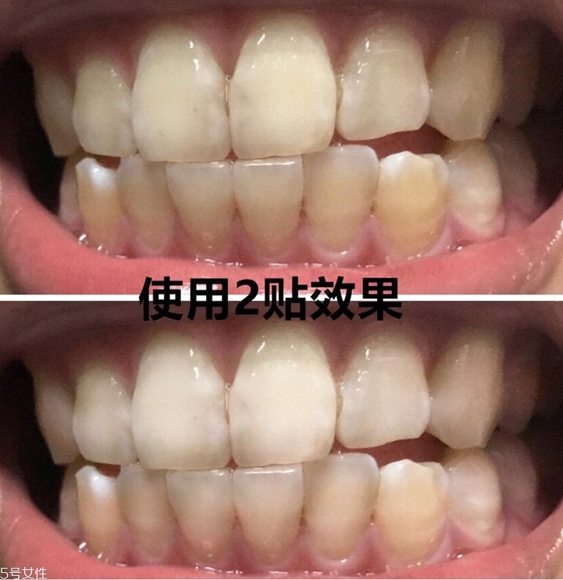 佳潔士美白牙貼貼多久有效？佳潔士美白牙貼使用感受