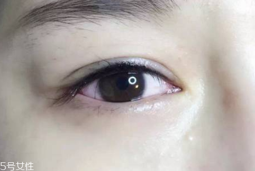 半永久美瞳線(xiàn)位置在哪 相當(dāng)脆弱的睫毛根部